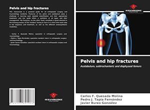 Pelvis and hip fractures