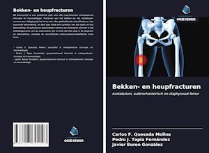 Bekken- en heupfracturen