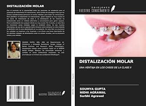 DISTALIZACIÓN MOLAR