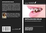 DISTALIZACIÓN MOLAR