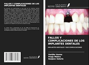 FALLOS Y COMPLICACIONES DE LOS IMPLANTES DENTALES