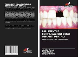 FALLIMENTI E COMPLICAZIONI DEGLI IMPIANTI DENTALI