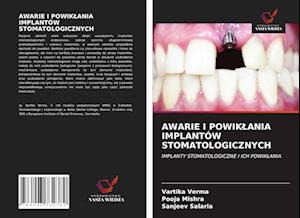 AWARIE I POWIKLANIA IMPLANTÓW STOMATOLOGICZNYCH