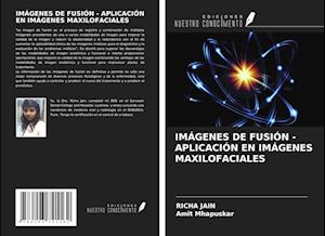 IMÁGENES DE FUSIÓN - APLICACIÓN EN IMÁGENES MAXILOFACIALES