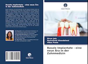 Basale Implantate - eine neue Ära in der Zahnmedizin