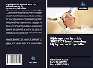 Bijdrage van hybride SPECT/CT beeldvorming bij hyperparathyroïdie