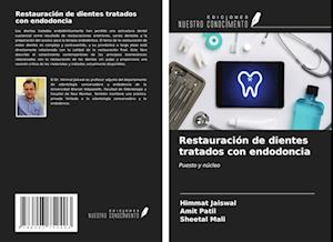 Restauración de dientes tratados con endodoncia