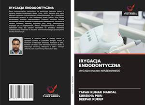 IRYGACJA ENDODONTYCZNA