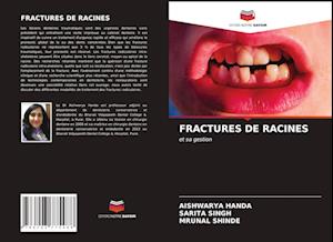 FRACTURES DE RACINES