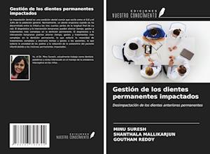 Gestión de los dientes permanentes impactados