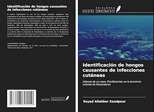 Identificación de hongos causantes de infecciones cutáneas