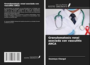 Granulomatosis renal asociada con vasculitis ANCA