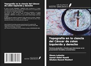 Topografía en la ciencia del Cáncer de colon izquierdo y derecho