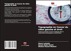 Topographie en Cancer du côlon gauche et droit