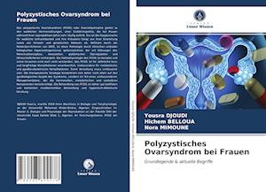 Polyzystisches Ovarsyndrom bei Frauen