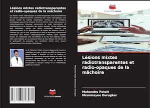 Lésions mixtes radiotransparentes et radio-opaques de la mâchoire