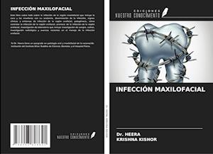 INFECCIÓN MAXILOFACIAL