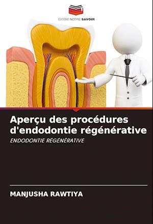 Aperçu des procédures d'endodontie régénérative