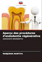 Aperçu des procédures d'endodontie régénérative