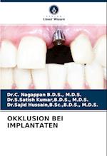 OKKLUSION BEI IMPLANTATEN