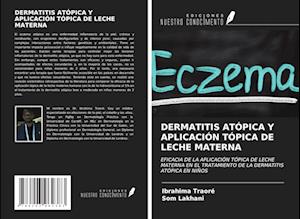 DERMATITIS ATÓPICA Y APLICACIÓN TÓPICA DE LECHE MATERNA