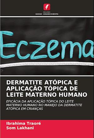 DERMATITE ATÓPICA E APLICAÇÃO TÓPICA DE LEITE MATERNO HUMANO