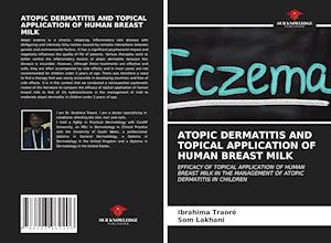 ATOPIC DERMATITIS AND TOPICAL APPLICATION OF HUMAN BREAST MILK