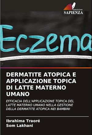 DERMATITE ATOPICA E APPLICAZIONE TOPICA DI LATTE MATERNO UMANO