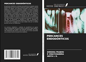 PERCANCES ENDODÓNTICOS