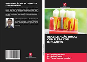 REABILITAÇÃO BUCAL COMPLETA COM IMPLANTES