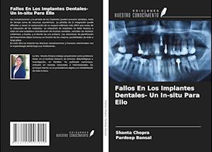 Fallos En Los Implantes Dentales- Un In-situ Para Ello