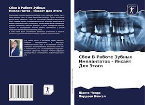 Sboi V Rabote Zubnyh Implantatow - Insajt Dlq Jetogo