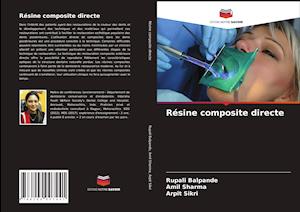 Résine composite directe