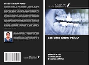 Lesiones ENDO-PERIO