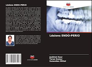 Lésions ENDO-PERIO