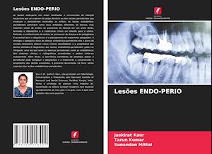 Lesões ENDO-PERIO