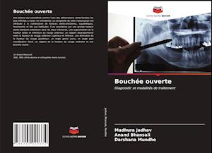 Bouchée ouverte