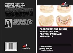 FABBRICAZIONE DI UNA STRUTTURA PER PROTESI PARZIALE RIMOVIBILE