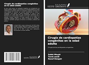 Cirugía de cardiopatías congénitas en la edad adulta