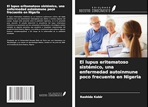 El lupus eritematoso sistémico, una enfermedad autoinmune poco frecuente en Nigeria