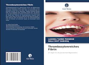 Thrombozytenreiches Fibrin