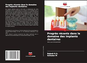 Progrès récents dans le domaine des implants dentaires