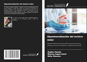 Hipomineralización del incisivo molar