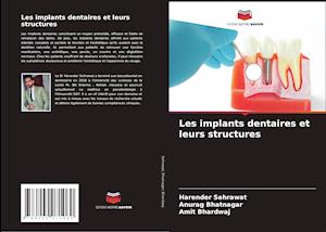 Les implants dentaires et leurs structures