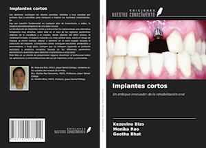 Implantes cortos