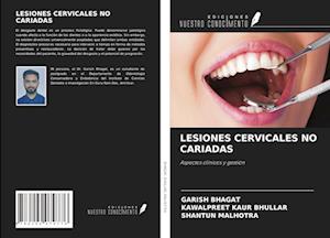 LESIONES CERVICALES NO CARIADAS