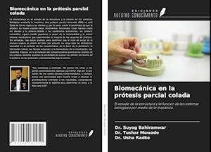 Biomecánica en la prótesis parcial colada