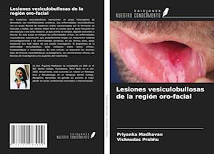 Lesiones vesiculobullosas de la región oro-facial