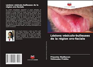 Lésions vésiculo-bulleuses de la région oro-faciale