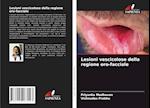 Lesioni vescicolose della regione oro-facciale